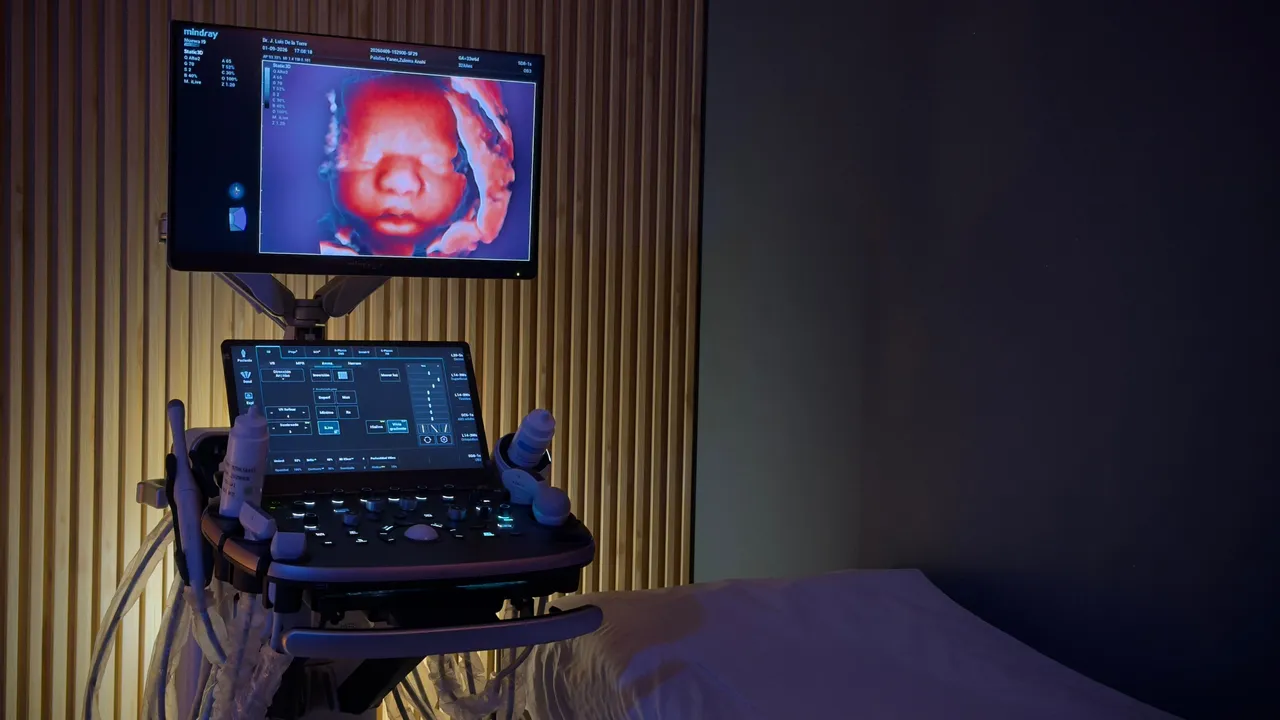 Ultrasonido 3D/4D - Dr. José Luis De la Torre